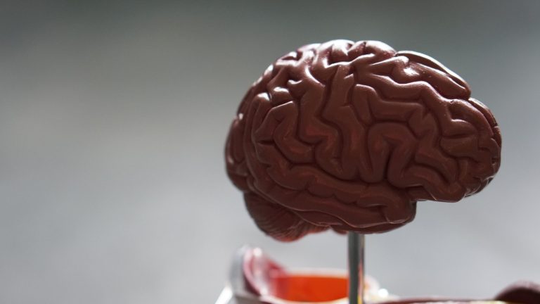 Read: The Costs of Developing Treatments for Alzheimer’s Disease: A Retrospective Exploration