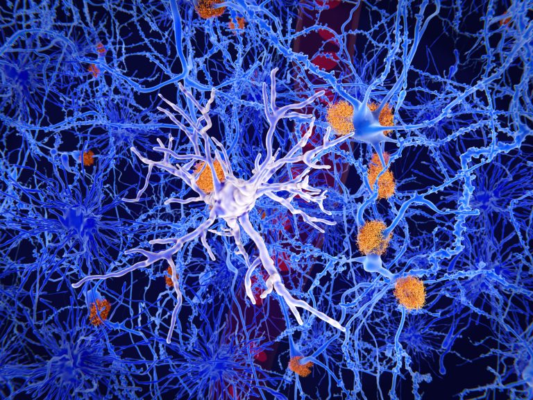Read: Knowledge and Attitudes Concerning Aducanumab Among Older Americans After FDA Approval for Treatment of Alzheimer Disease
