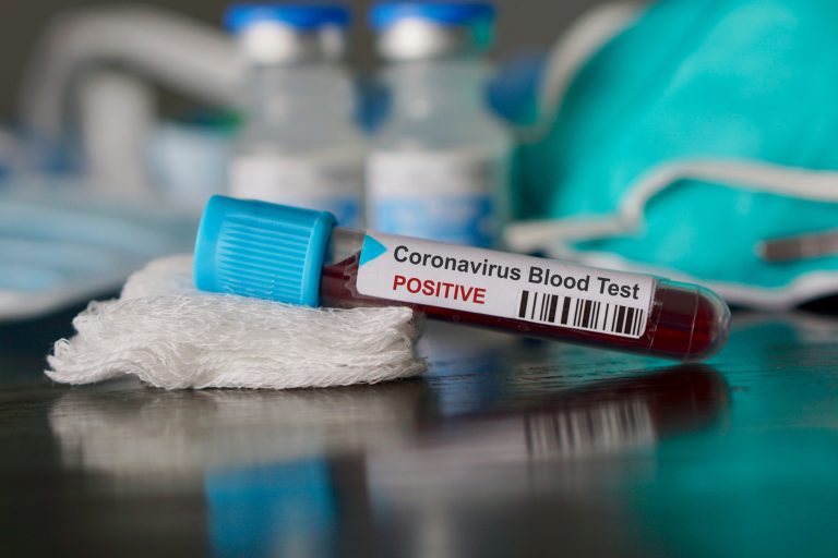 Read: Seroprevalence of Antibodies Specific to Receptor Binding Domain of SARS-CoV-2 and Vaccination Coverage Among Adults in Los Angeles County, April 2021: The LA Pandemic Surveillance Cohort Study