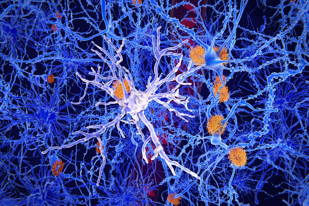 Read: Eligibility Rates among Racially and Ethnically Diverse US Participants in Phase 2 and Phase 3 Placebo-Controlled, Double-Blind, Randomized Trials of Lecanemab and Elenbecestat in Early Alzheimer Disease