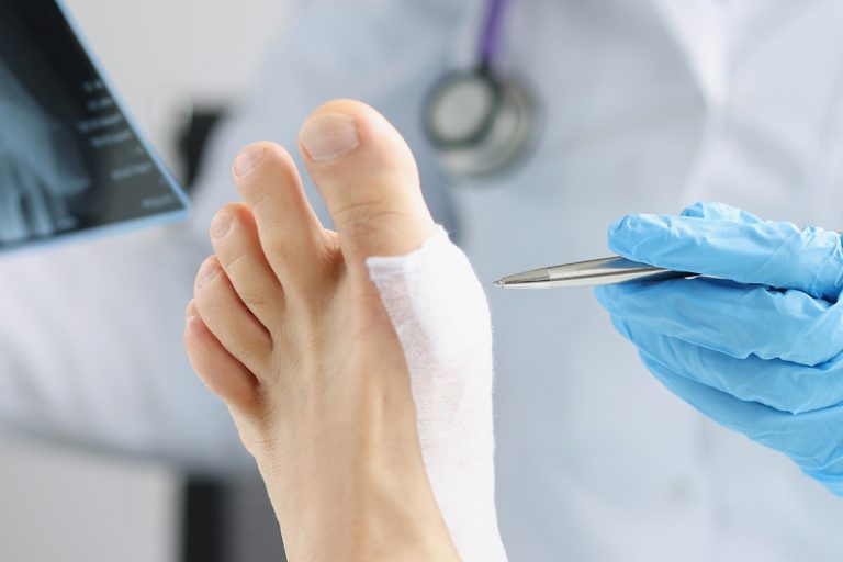 Read: Comparative Effectiveness of Placental Allografts in the Treatment of Diabetic Lower Extremity Ulcers and Venous Leg Ulcers in U.S. Medicare Beneficiaries: A Retrospective Observational Cohort Study Using Real-World Evidence